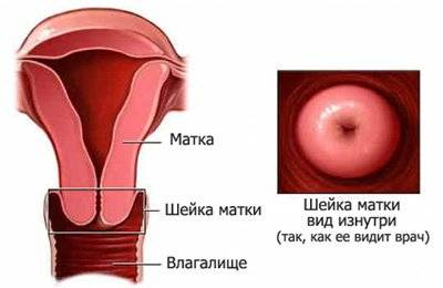 шейка матки фото