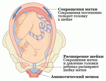 схватки перед родами