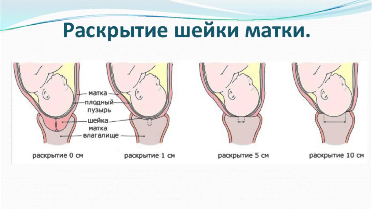этап родов