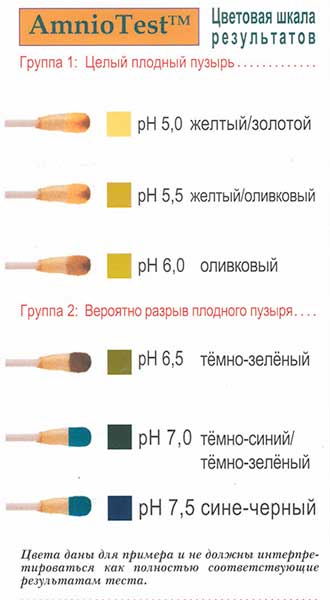отхождение околоплодных вод