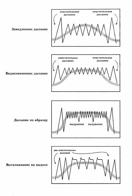 роды без боли