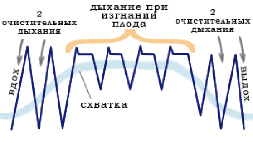 роды без боли