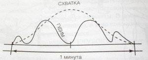 роды без боли