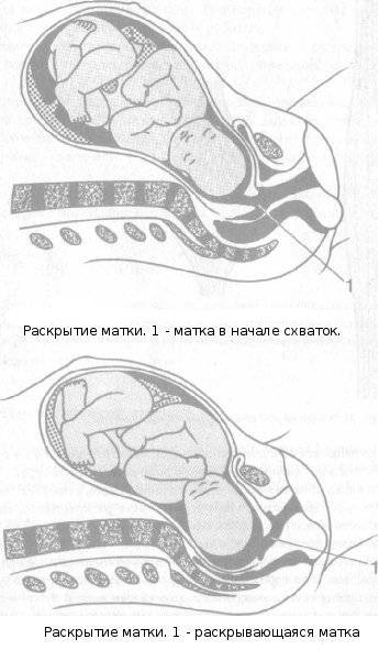 этап родов