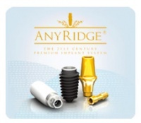Имплантаты AnyRidge – быстро, безболезненно, эстетично